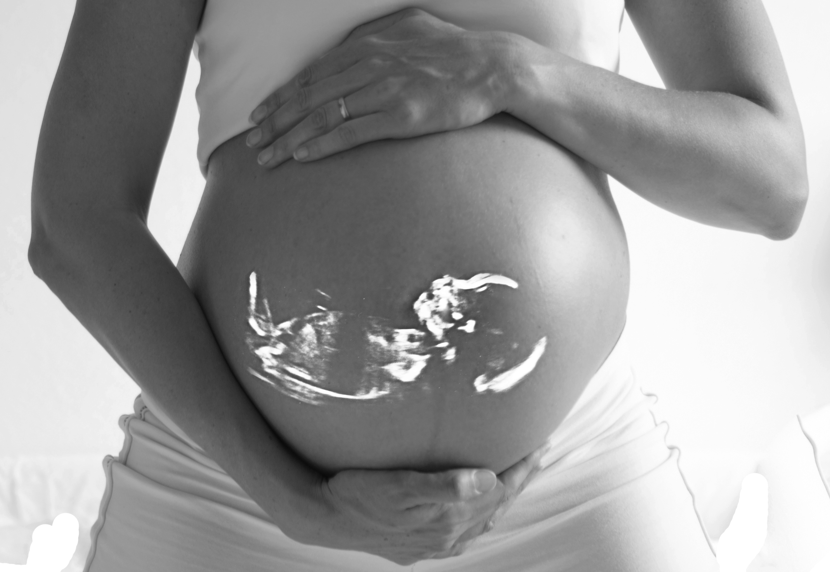 Consejos para evitar el estrés en el embarazo