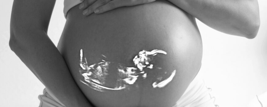 Las diferencias entre “cigoto”, “embrión” y “feto” durante el embarazo. Accuna